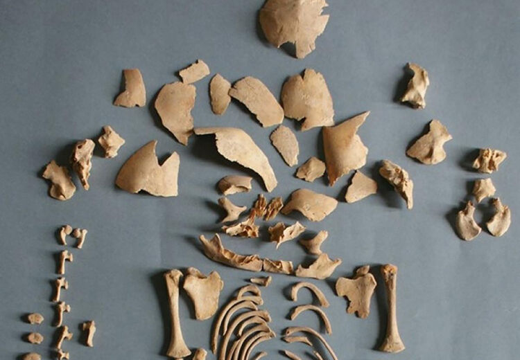 Overblijfselen van mens “CRU001” uit de ijzertijd. Onderzoekers ontdekten dat het het syndroom van Down had.