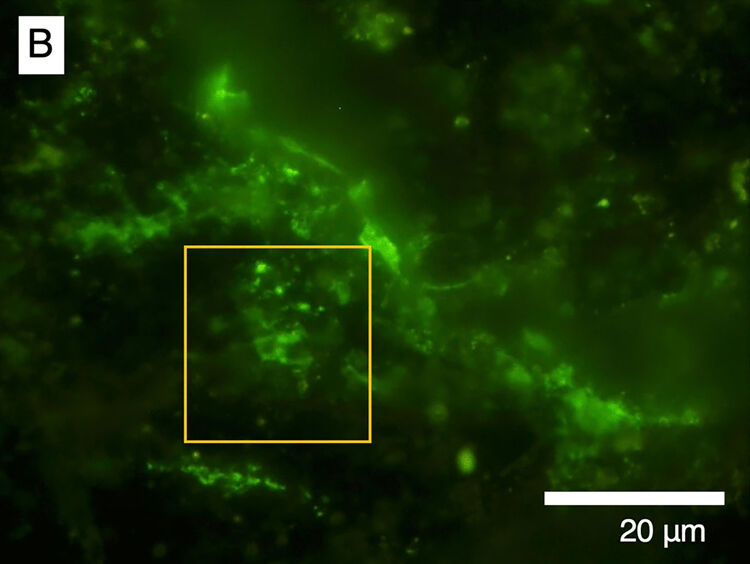 Met een speciale groene vloeistof geven de microben licht waardoor je ze beter kunt zien.