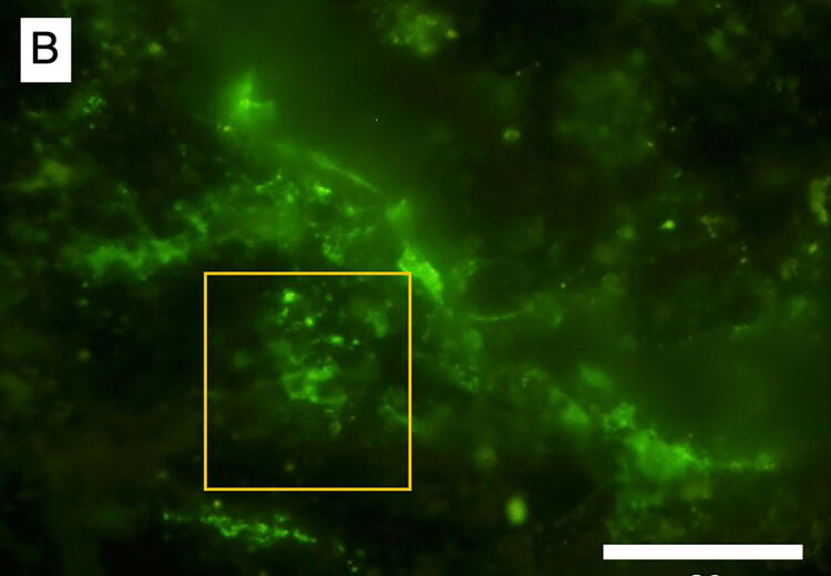 Met een speciale groene vloeistof geven de microben licht waardoor je ze beter kunt zien.