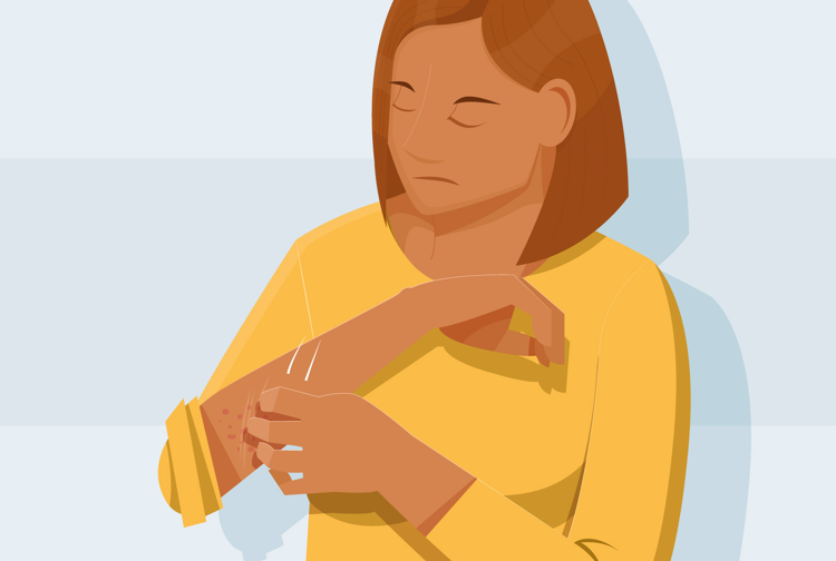 Van schurft krijg je jeuk en uitslag. Met zalf of pillen is het goed te behandelen.