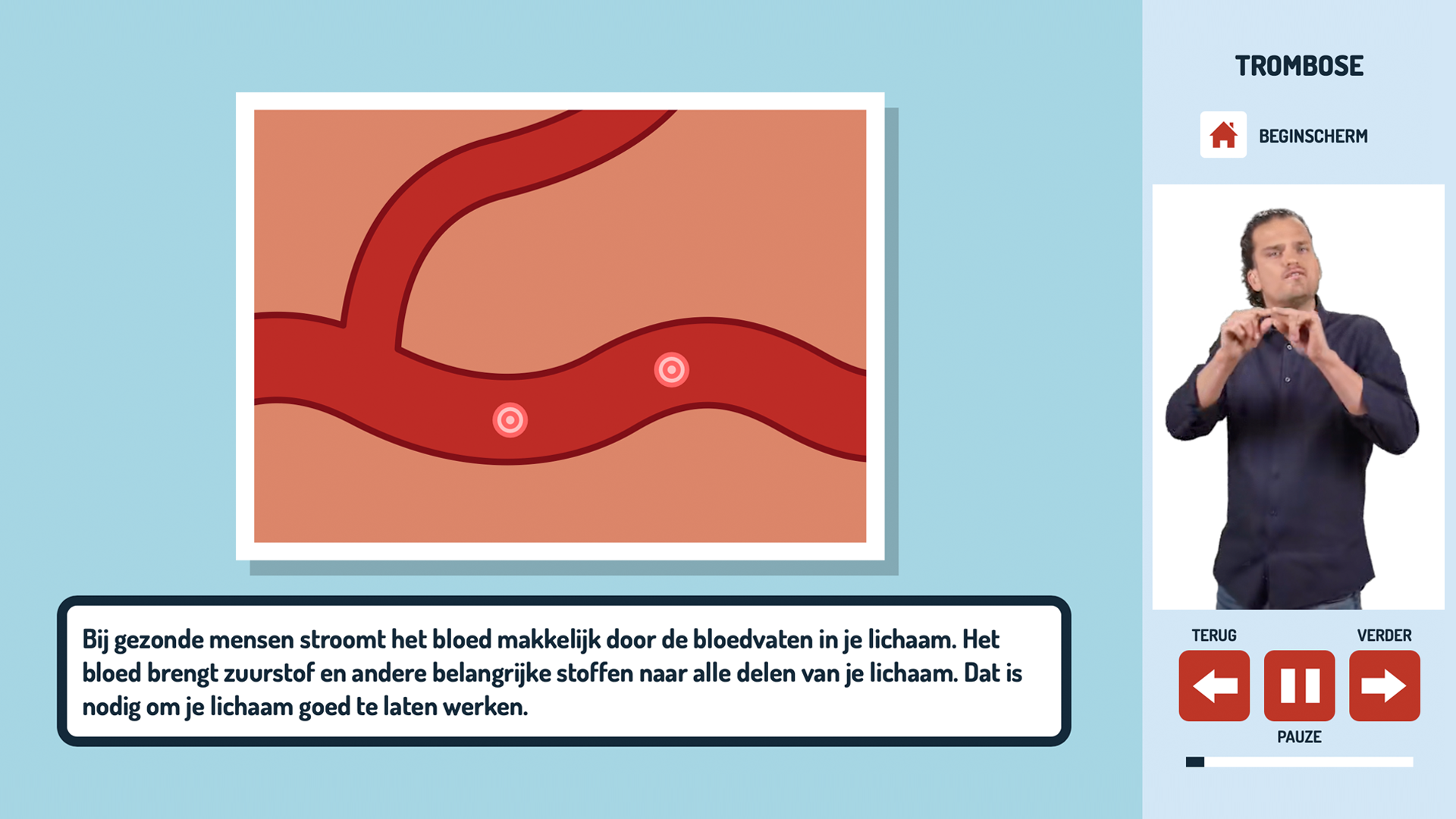 Alles over trombose ook in gebarentaal